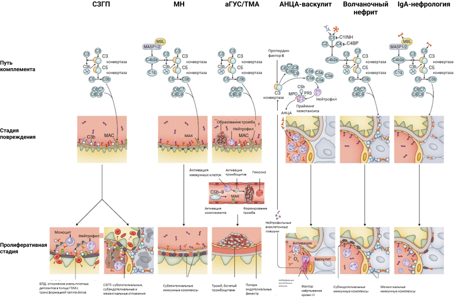 Роль системы комплемента при различных заболеваниях почек, согласно резолюции KDIGO 20241